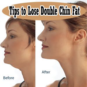 How to Lose Double Chin Fat