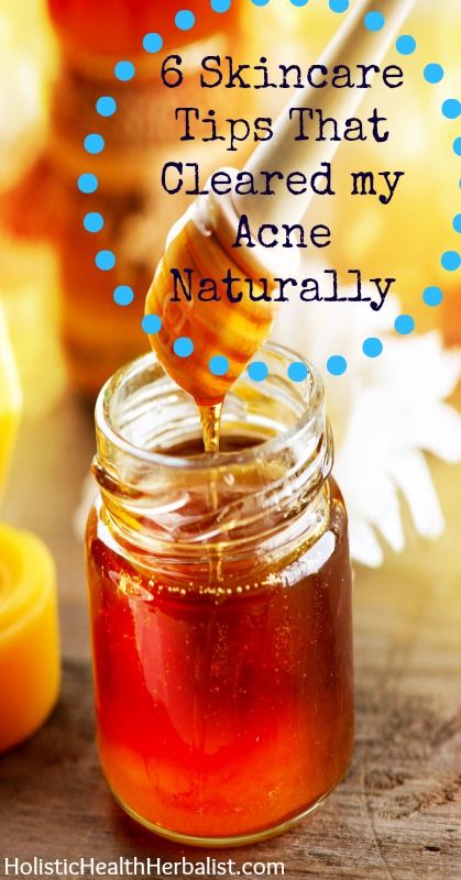 Skincare Tips That Cleared My Ace Naturally