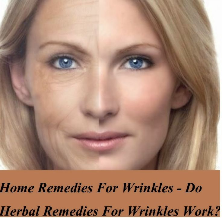 Home Remedies For Wrinkles - Do Herbal Remedies For Wrinkles Work Myth Exposed