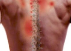 Upper Back Pain find out how to relieve it with yoga