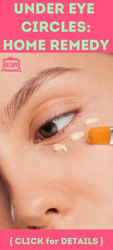 Home Remedy for Circles Under the Eyes