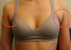 Get Rid Of Your Armpit Fat In Two Weeks