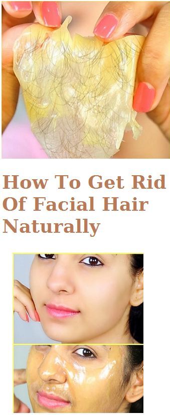  How To Get Rid Of Facial Hair Naturally 