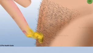 This Is How You Can Remove Body Hair Permanently