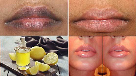 MAKE YOUR LIPS SOFT AND PINK IN JUST 10 MINUTES WITH NATURAL REMEDIES