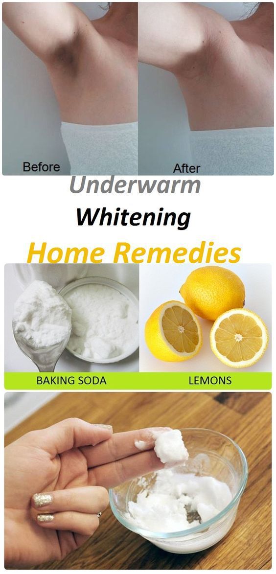 Underarm Whitening Home Remedies