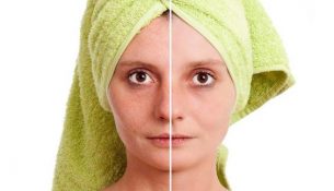 How To Shrink Pores