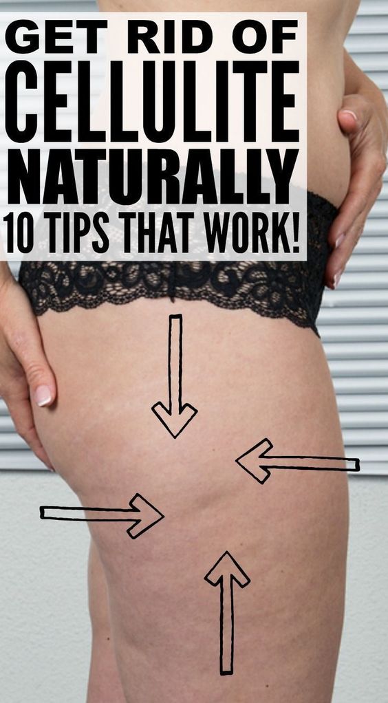 How to Get Rid of Cellulite 10 Natural Remedies That Work