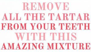 Try This Amazing Mixture And Remove All the Tartar From Your Teeth