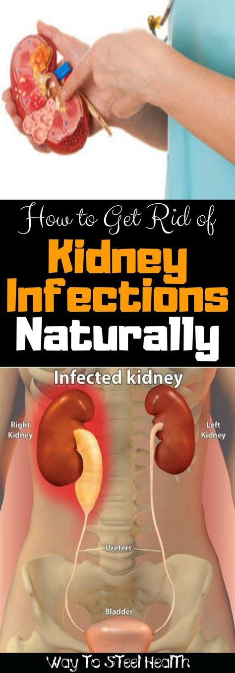 how to get rid of kidney infections naturally