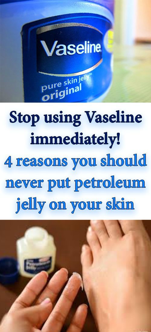 STOP USING VASELINE IMMEDIATELY! 4 REASONS YOU SHOULD NEVER PUT PETROLEUM JELLY ON YOUR SKIN