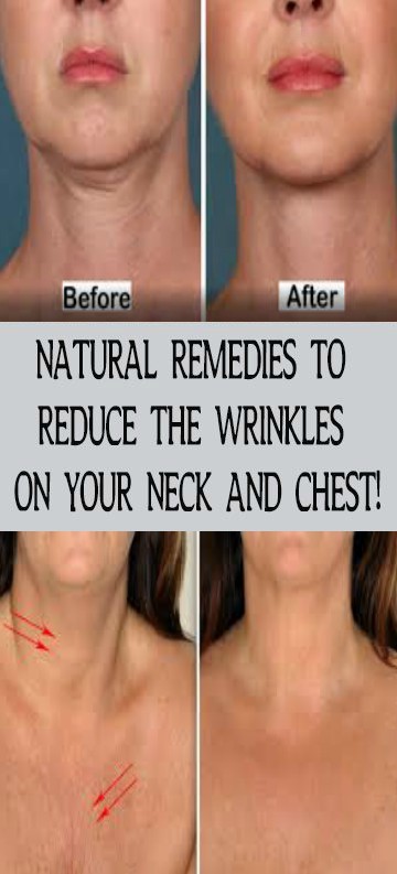 NATURAL REMEDIES TO REDUCE THE WRINKLES ON YOUR NECK AND CHEST!