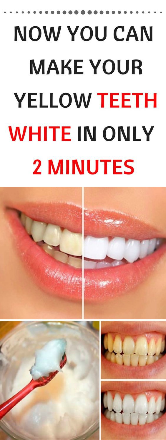 NOW YOU CAN MAKE YOUR YELLOW TEETH WHITE IN ONLY 2 MINUTES!