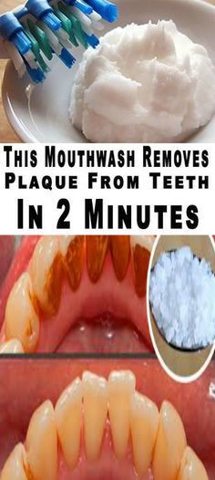 This Mouthwash Removes Plaque From Teeth In 2 Minutes