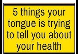 Here 5 Things Your Tongue Is Trying To Tell You About Your Health!!!