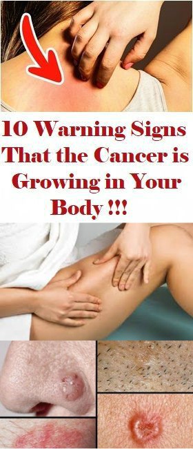 10 WARNING SIGNS THAT THE CANCER IS GROWING IN YOUR BODY!