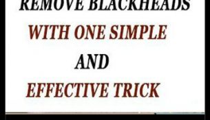 Remove Blackheads With One Simple And Effective Trick
