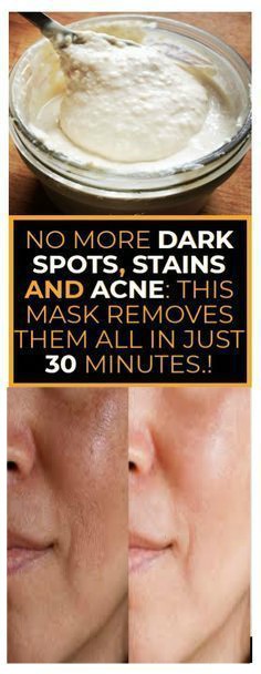 NO MORE DARK SPOTS, STAINS AND ACNE THIS CHINESE MASK REMOVES THEM ALL IN JUST 30 MINUTES.!