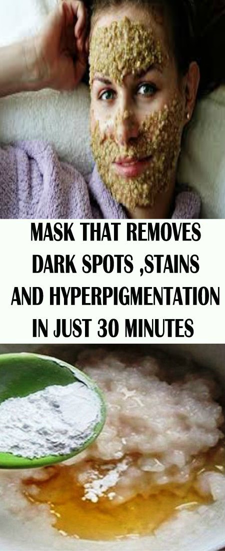 Mask That Removes Dark Spots,stains & Hyperpigmentation In Just 30 Minutes