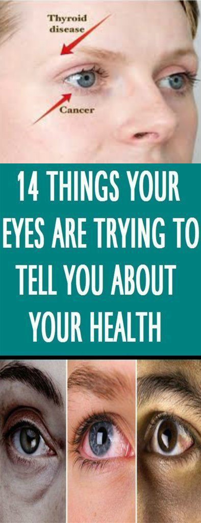 14 Things Your Eyes Can Tell You about Your Health (If you know what to look for)
