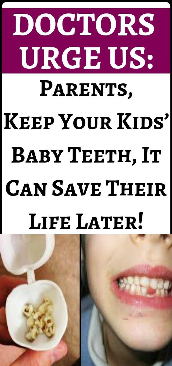 Doctors Urge Parents: Keep Your Kids’ Baby Teeth