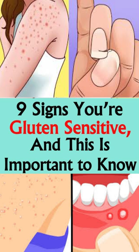 9 Signs You’re Gluten Sensitive, and This Is Important to Know