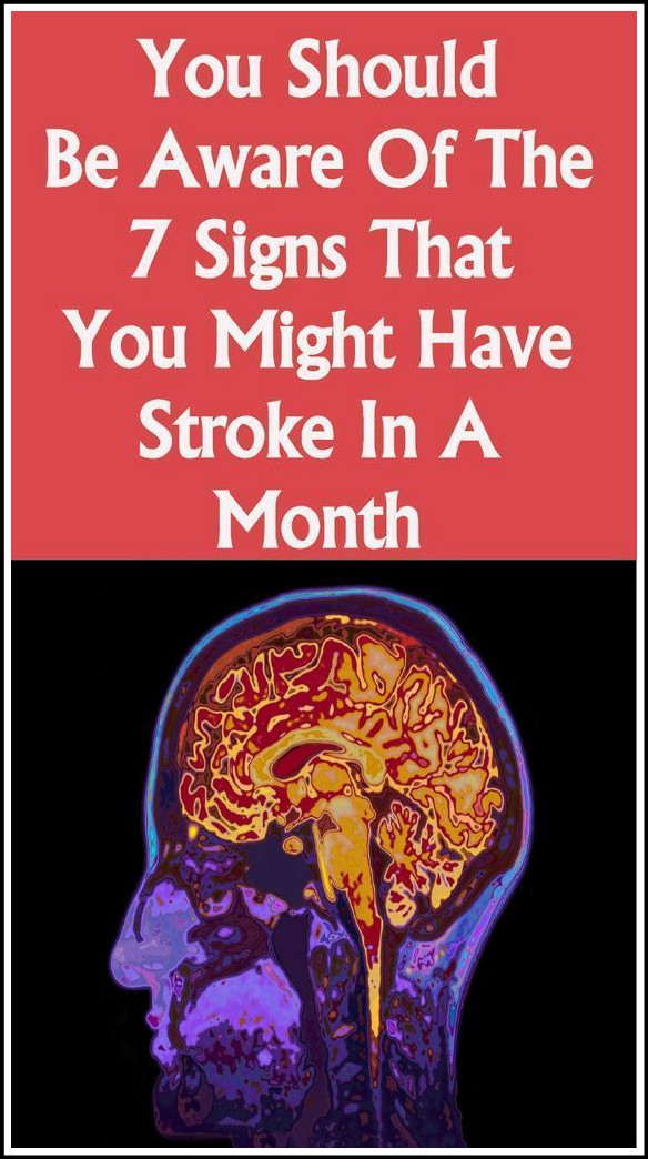 You should be aware of the 7 signs that you might have stroke in a month