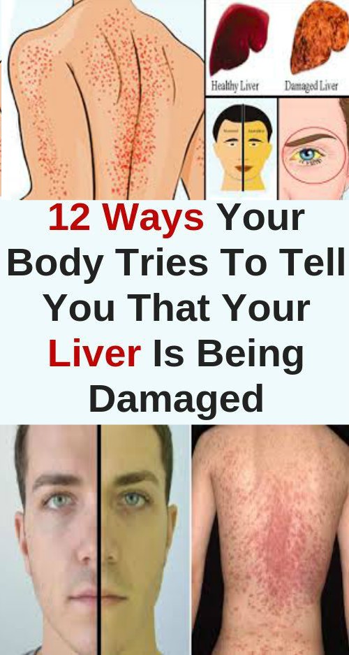 12 Ways Your Body Tries To Tell You That Your Liver Is Being Damaged