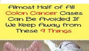 Almost Half of All Colon Cancer Cases Can Be Avoided If We Keep Away from These 7 Things