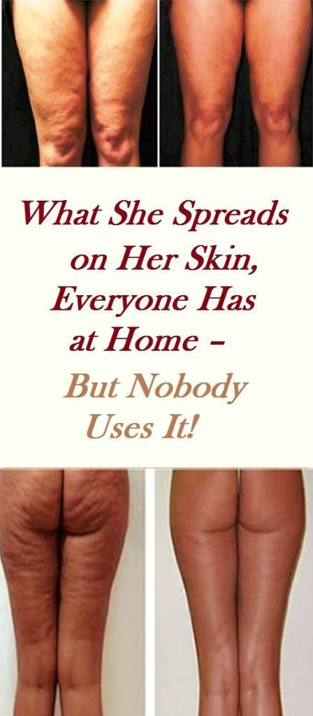 What She Spreads On Her Skin, Everyone Has at Home – But Nobody Uses It!