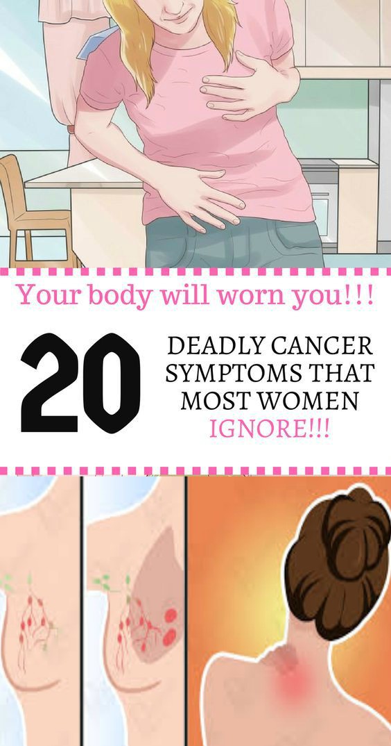 20 DEADLY CANCER SYMPTOMS THAT MOST WOMEN IGNORE!