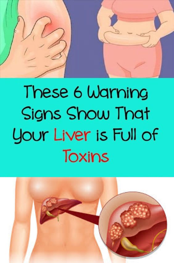 These 6 Warning Signs Show That Your Liver is Full of Toxins