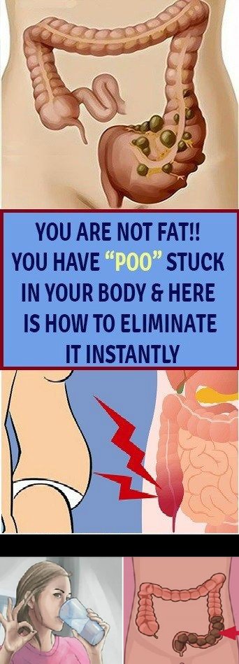 YOU ARE NOT FAT! YOU HAVE “POO” STUCK IN YOUR BODY & HERE IS HOW TO ELIMINATE IT INSTANTLY