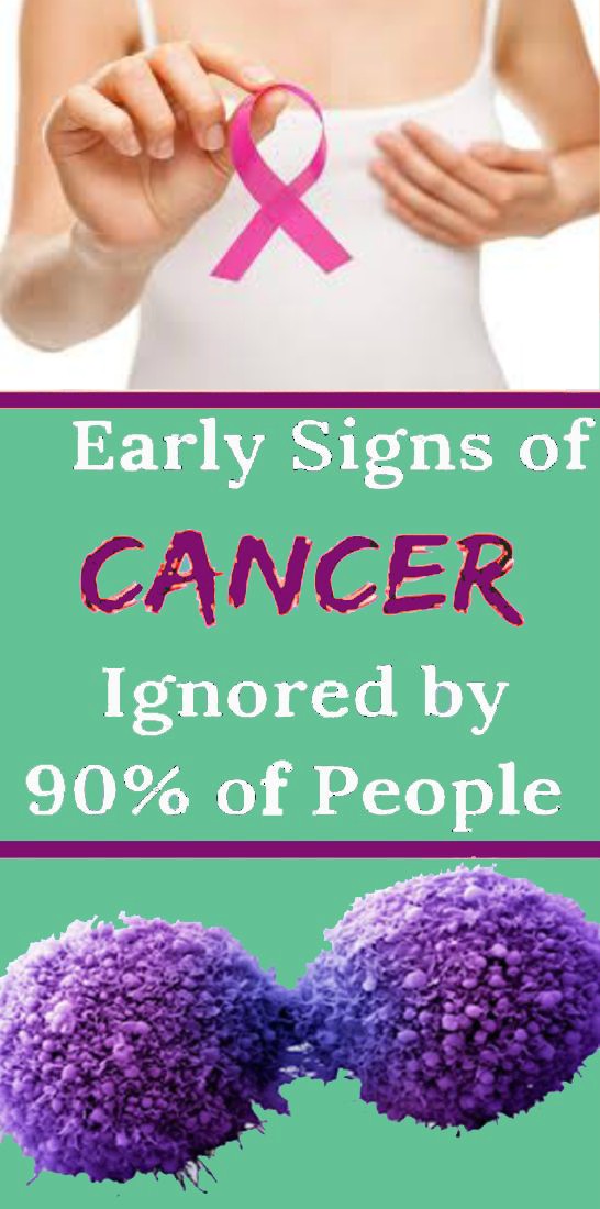 10 Signs of Cancer That Women Shouldn’t Ignore