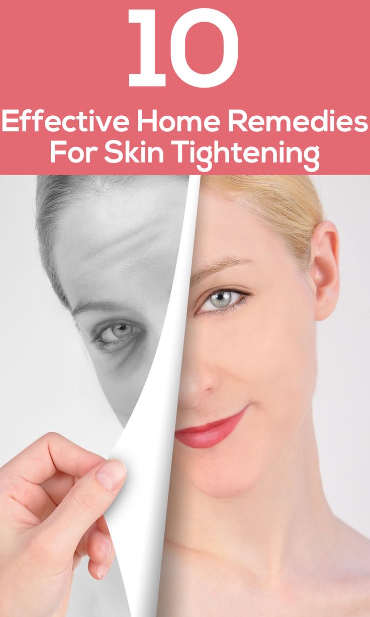 10 Effective Home Remedies For Skin Tightening