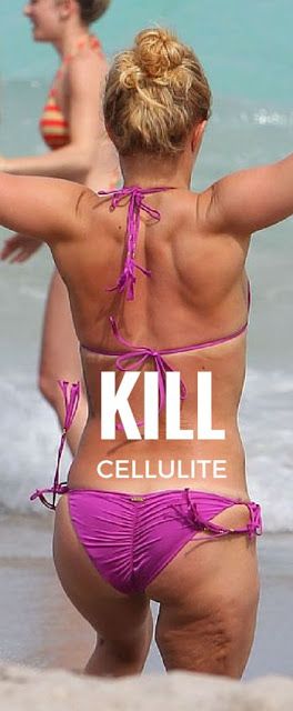 5 Critical Ways To Kill Cellulite