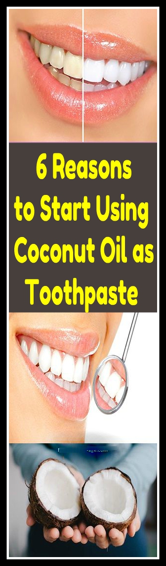 6 Reasons to Start Using Coconut Oil as Toothpaste 1 6 Reasons to Start Using Coconut Oil as Toothpaste