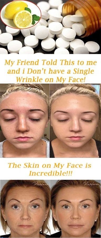 I Don’t Have A Single Mole and Wrinkle On My Face! The Skin On My Face Is Incredibly Clear