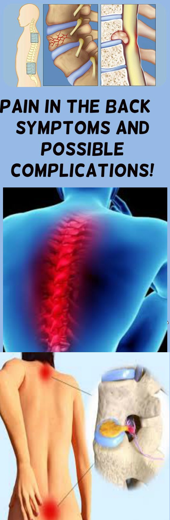 Pain In The Back – SYMPTOMS AND POSSIBLE COMPLICATIONS!