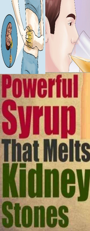 POWERFULL SYRUP THAT MELT KIDNEY STONS