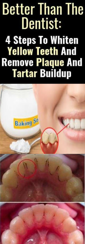 4 EASY STEPS TO WHITEN YELLOW TEETH AND REMOVE PLAQUE AND TARTAR BUILDUP
