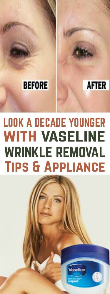 Look a Decade Younger With Vaseline Wrinkle Removal