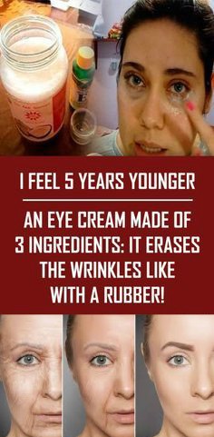 I Feel 5 Years Younger – An Eye Cream Made of 3 Ingredients: It Erases the Wrinkles Like With a Rubber!
