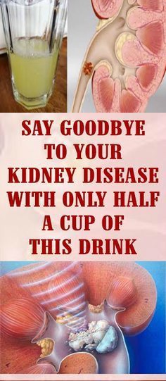 13 SAY GOODBYE TO YOUR KIDNEY DISEASE WITH ONLY HALF A CUP OF THIS DRINK