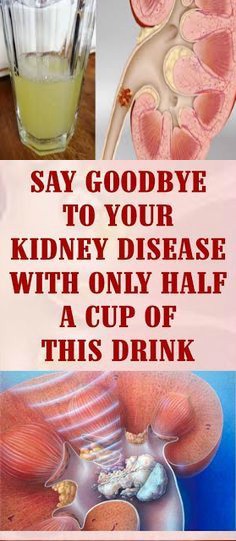 SAY GOODBYE TO YOUR KIDNEY DISEASE WITH ONLY HALF A CUP OF THIS DRINK