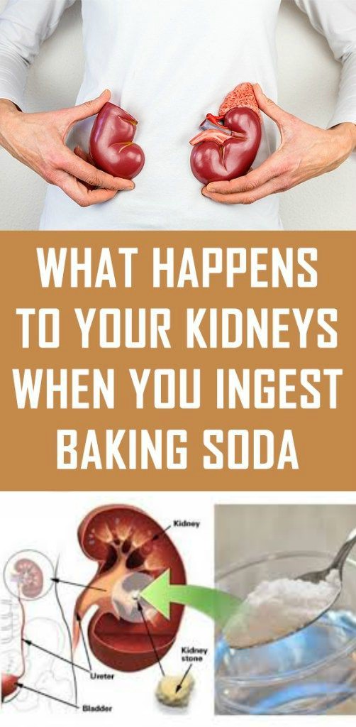 What Happens to Your Kidneys When You Ingest Baking Soda