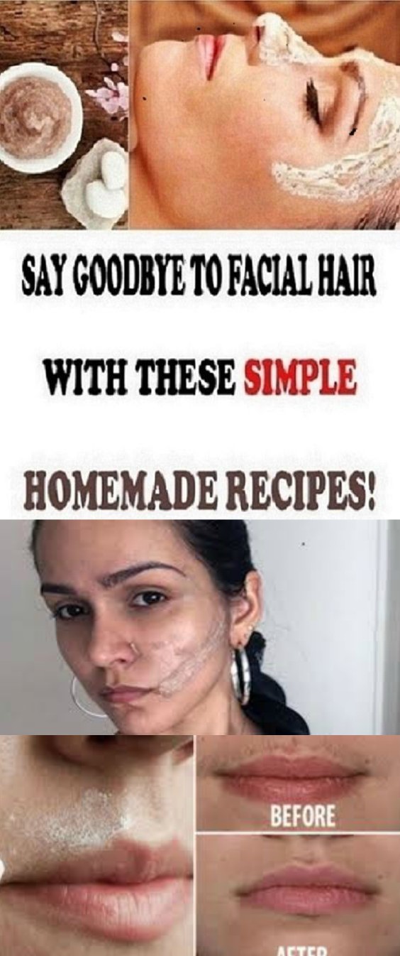 17 2 SAY GOODBYE TO FACIAL HAIR FOR GOOD WITH THESE SIMPLE HOMEMADE RECIPES