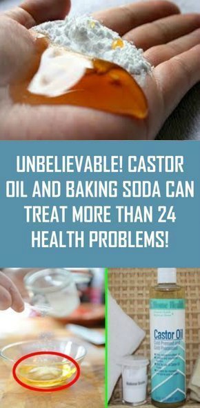 UNBELIEVABLE! CASTOR OIL AND BAKING SODA CAN TREAT MORE THAN 24 HEALTH PROBLEMS!