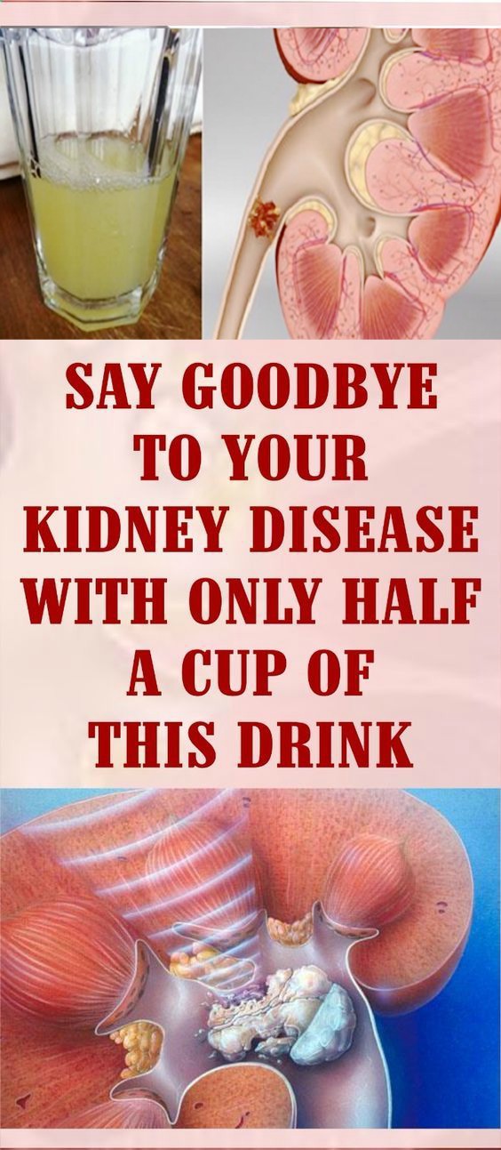 SAY GOODBYE TO YOUR KIDNEY DISEASE WITH ONLY HALF A CUP OF THIS DRINK