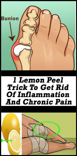 Did You Know That Lemon Peels Can Eliminate Your Joint Pain Once And For All Did You Know That Lemon Peels Can Eliminate Your Joint Pain Once And For All